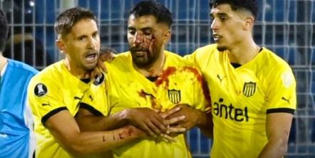 Escándalo en Central-Peñarol y un jugador uruguayo ensangrentado: volvieron los visitantes y también la violencia
