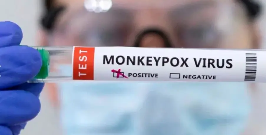 Ya son 32 los casos de viruela del mono en la Argentina: cuáles son los síntomas más frecuentes