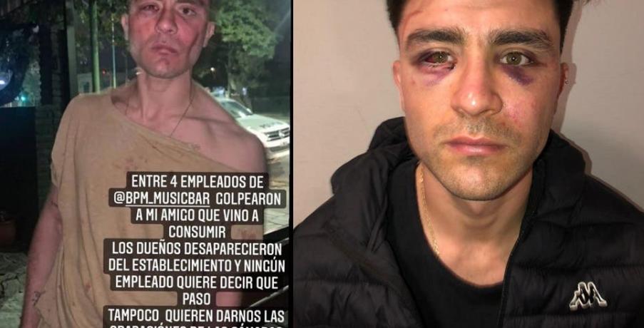 Un joven recibió una brutal golpiza en un conocido bar de la Mate de Luna